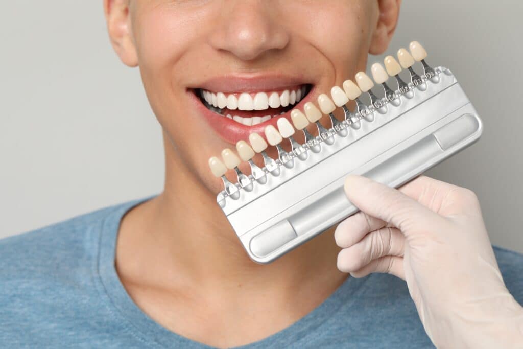 dental veneers near me