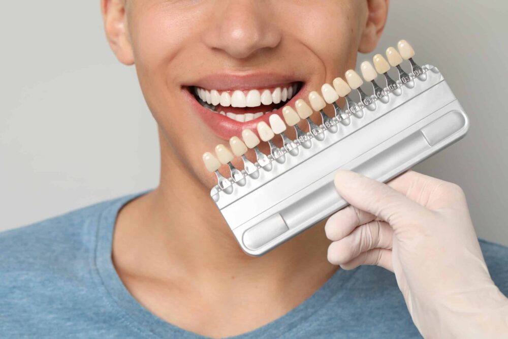 dental veneers near me